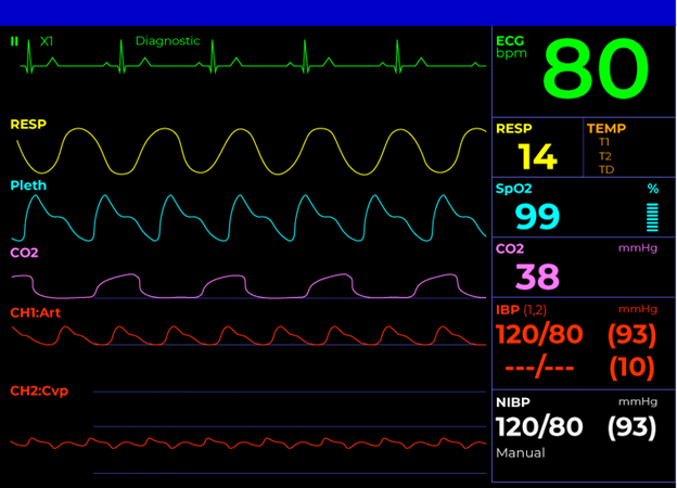 Image shows Figure 1 Vital Sign Monitoring Screen